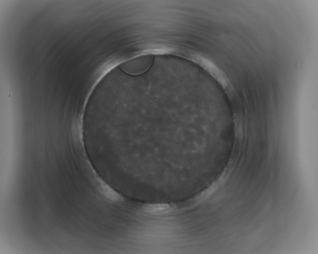 X0000111441186200907201122