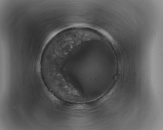 X0000111441279200907201121