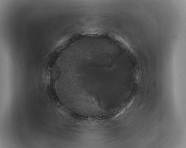 X0000111441350200907201120