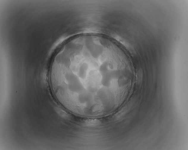 X0000111441454200907201119