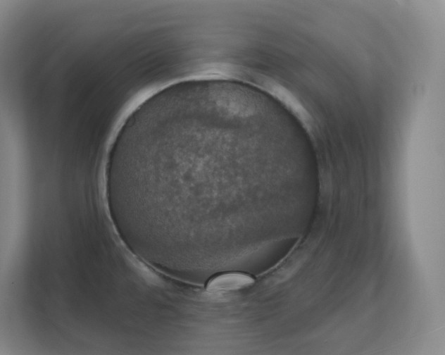 X0000111441480200907201119