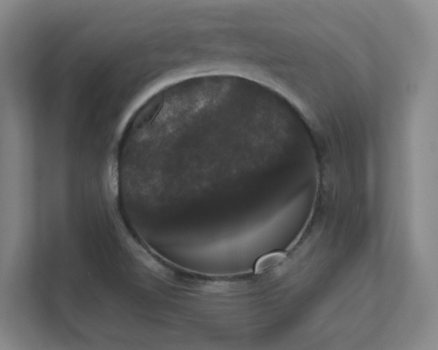 X0000111441510200907201118