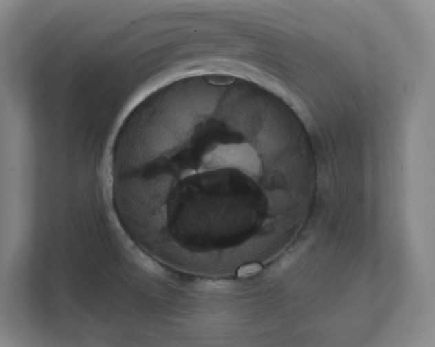 X0000111441522200907201118