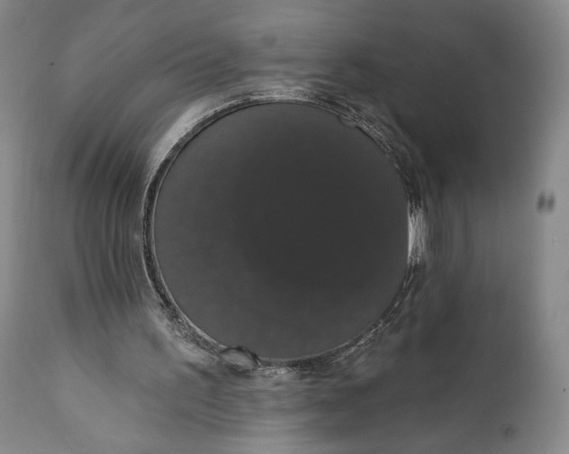 X0000111440195200907271138