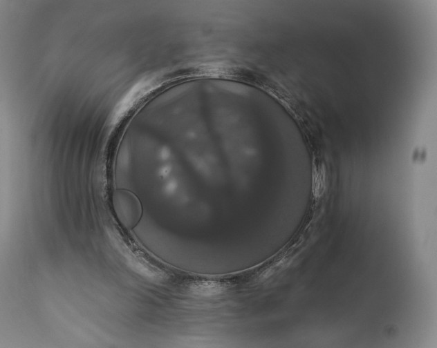 X0000111440198200907271138