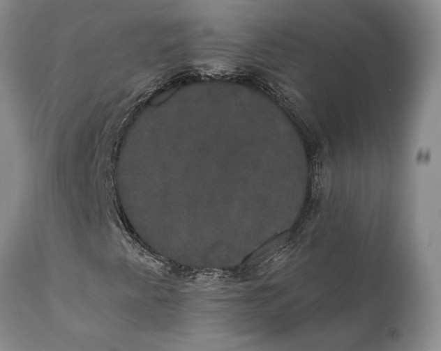 X0000111441345200907271120