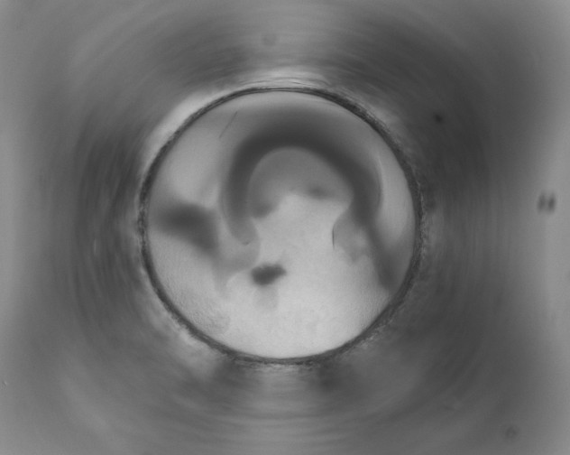 X0000111441470200907271118