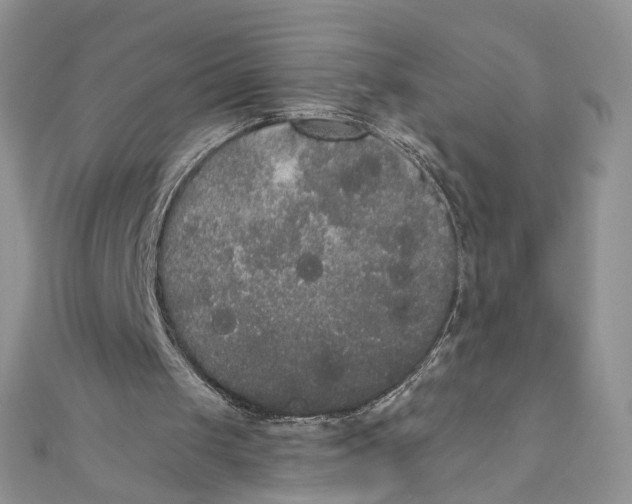 X0000111440049200908031401