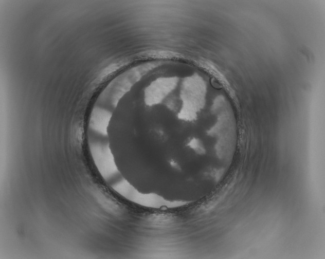 X0000111440063200908031401