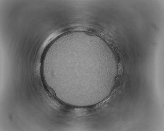 X0000111440150200908031359