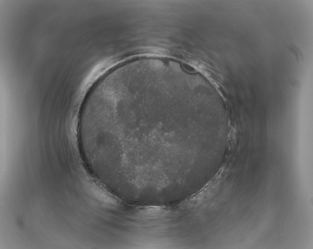 X0000111440151200908031359