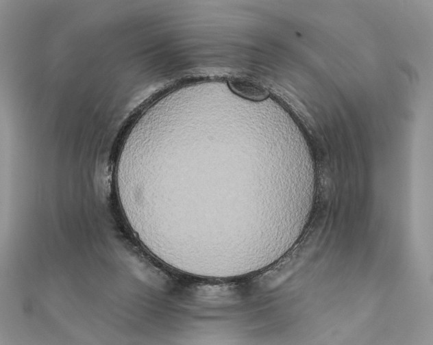 X0000111440160200908031359