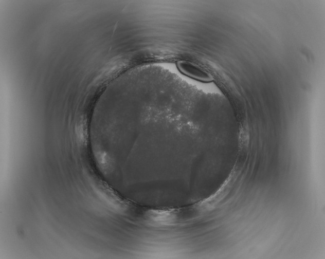 X0000111440170200908031359