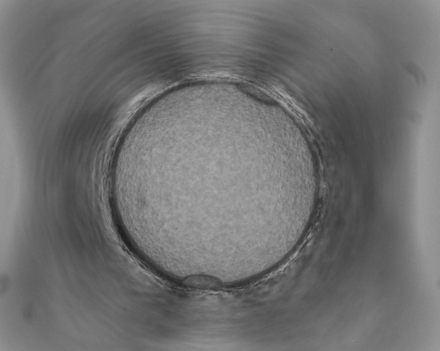 X0000111440193200908031359