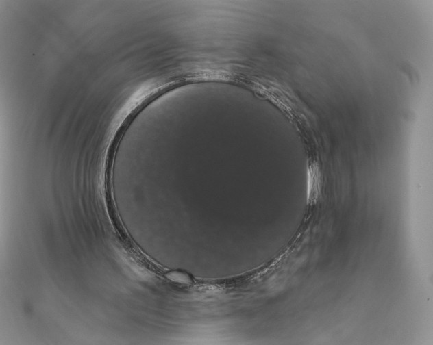 X0000111440195200908031359