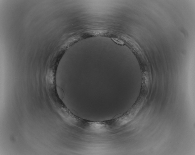 X0000111440380200908031357