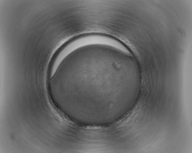 X0000111440440200908031355