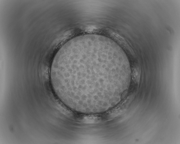 X0000111440470200908031356