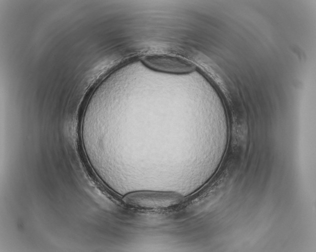 X0000111440485200908031355