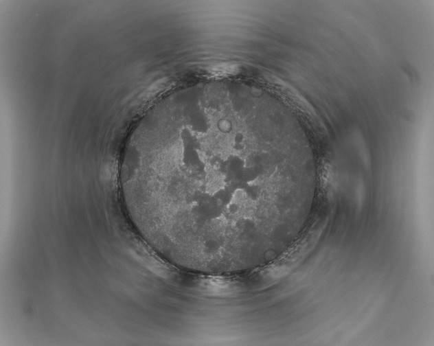 X0000111440565200908031354