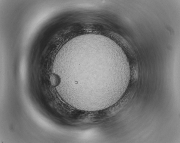 X0000111440764200908031352