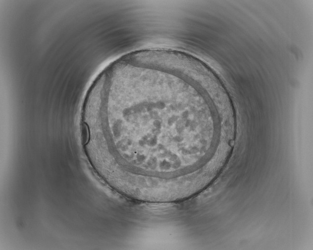 X0000111440864200908031351