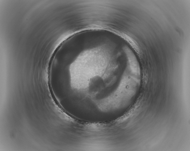 X0000111440950200908031350