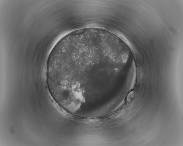 X0000111441148200908031347