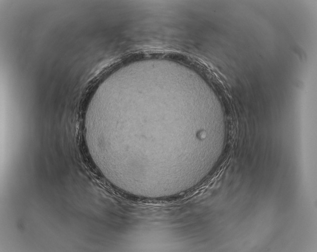 X0000111441157200908031347