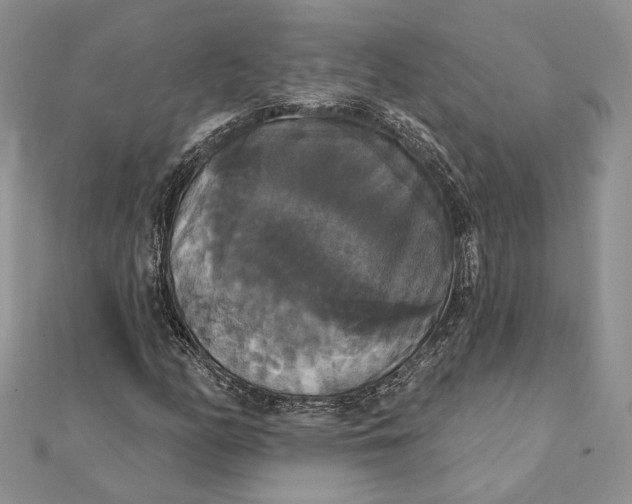 X0000111441158200908031347