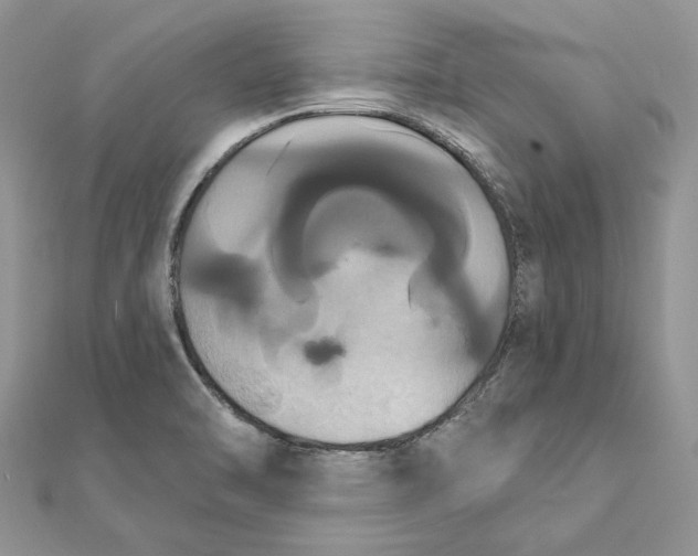 X0000111441470200908031343