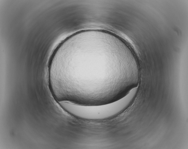 X0000111441472200908031343