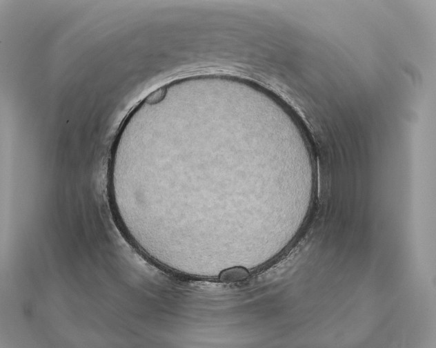 X0000111441500200908031341