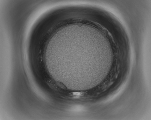 X0000111440050200908101022