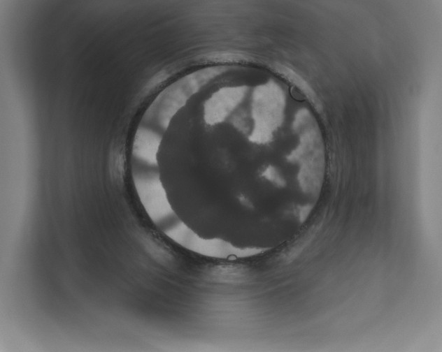 X0000111440063200908101023