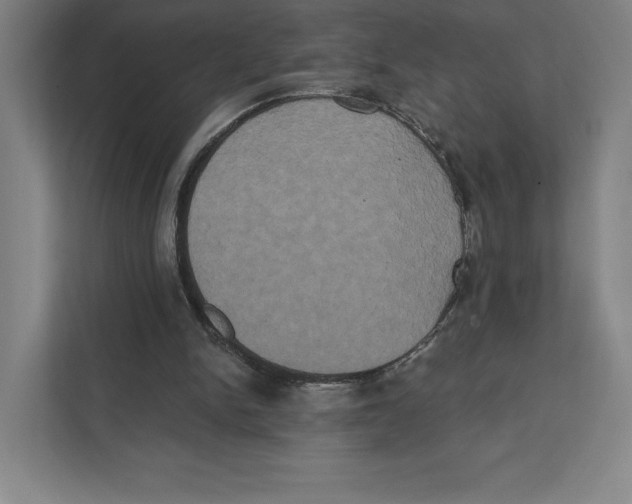 X0000111440150200908101021