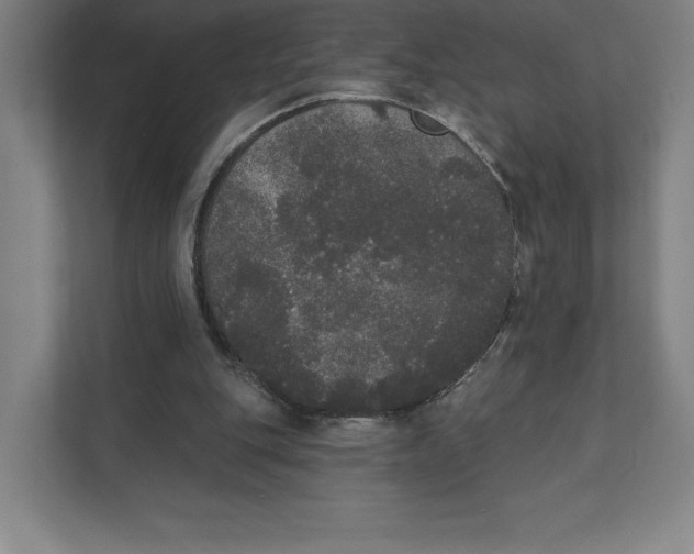 X0000111440151200908101021