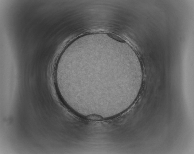 X0000111440193200908101021