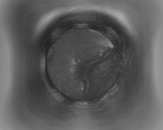 X0000111440194200908101021