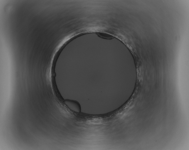 X0000111440196200908101021