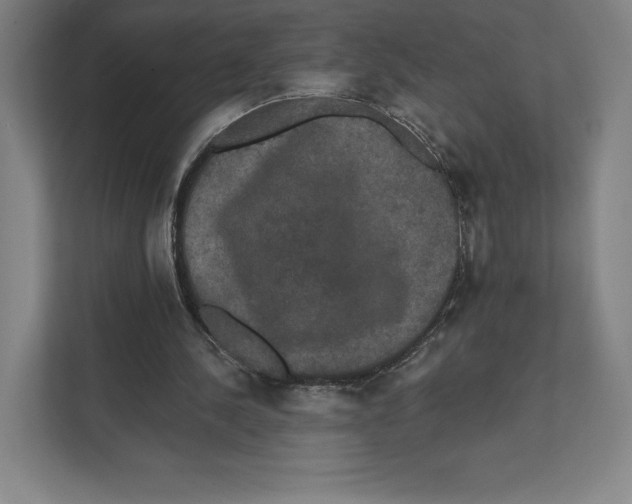 X0000111440244200908101020