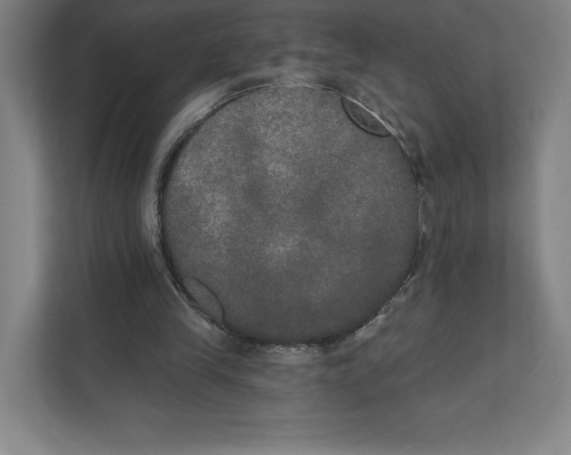 X0000111440245200908101020