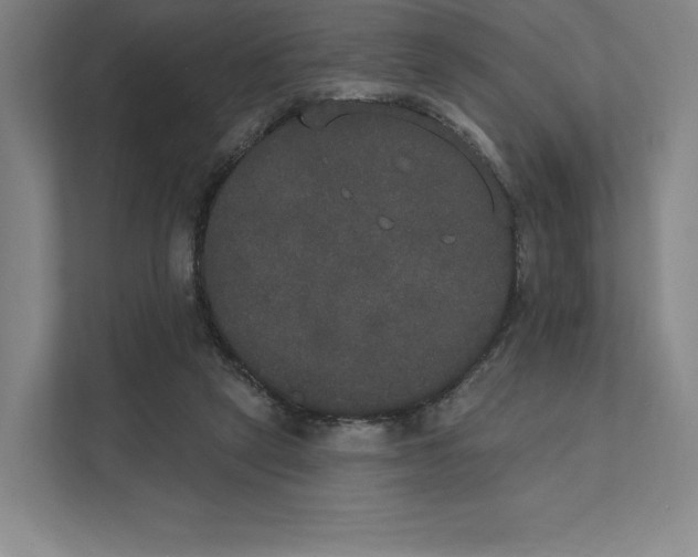 X0000111440257200908101020