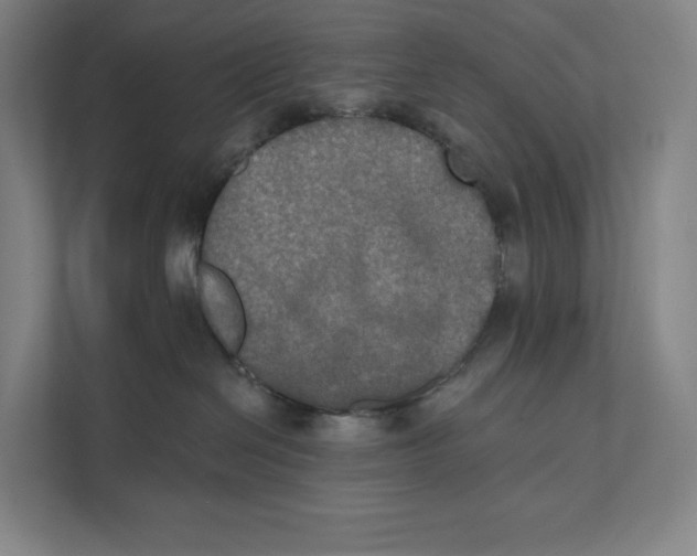 X0000111440286200908101021