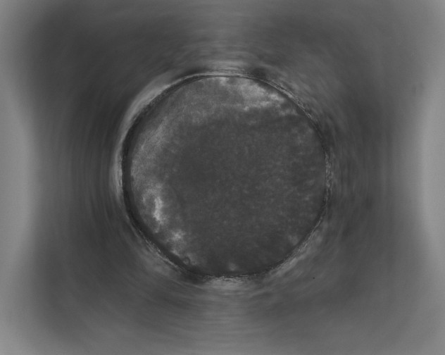 X0000111440294200908101020