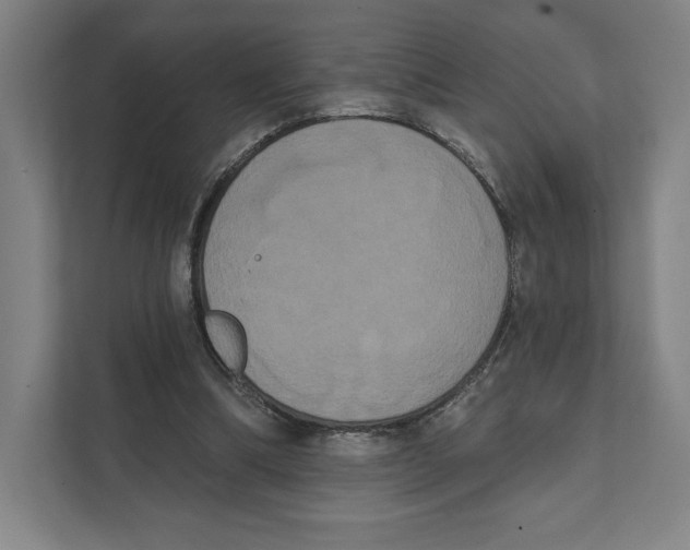 X0000111440298200908101020