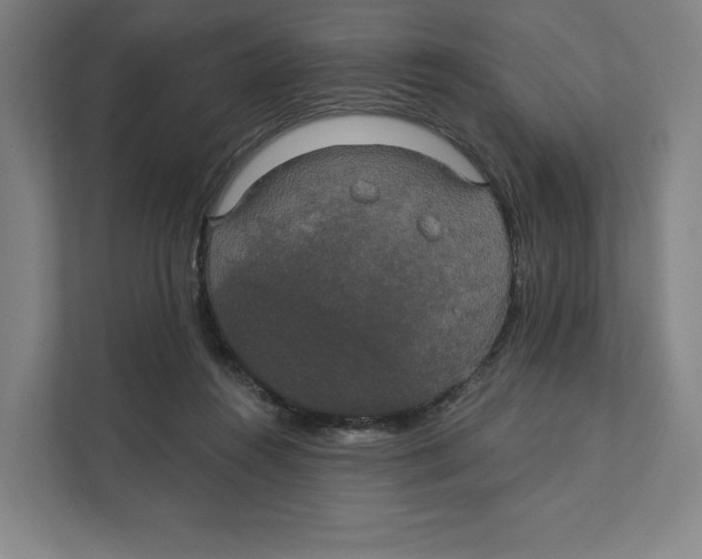 X0000111440360200908101019