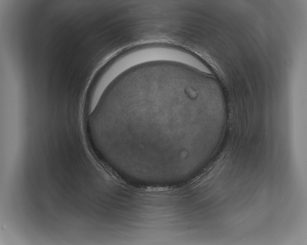 X0000111440440200908101018