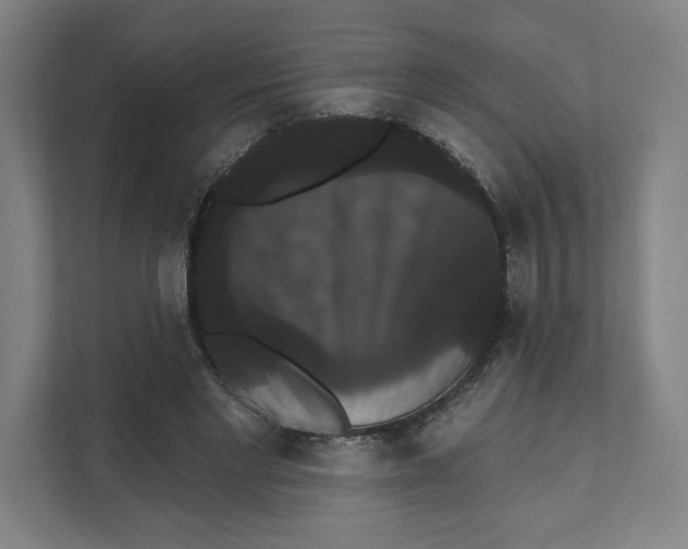 X0000111440493200908101017