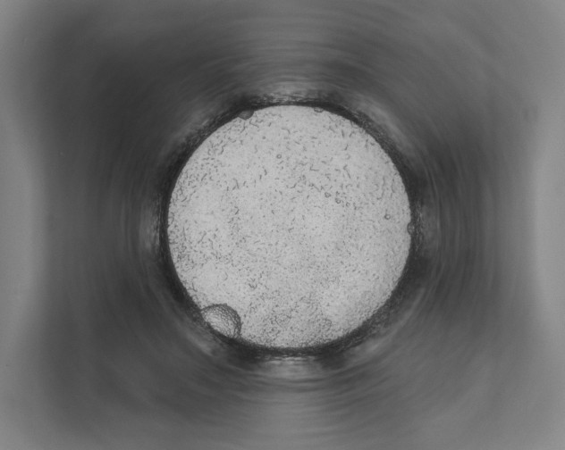 X0000111440499200908101017